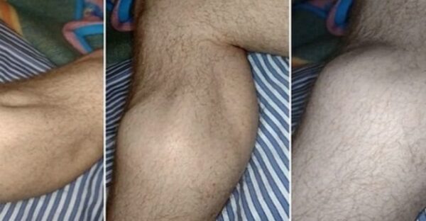 5 façons pour soulager les crampes aux jambes durant la nuit et comment les prévenir