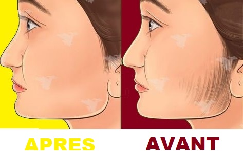 Poils sur le Visage  : Les 4 techniques les plus efficaces pour les retirer.