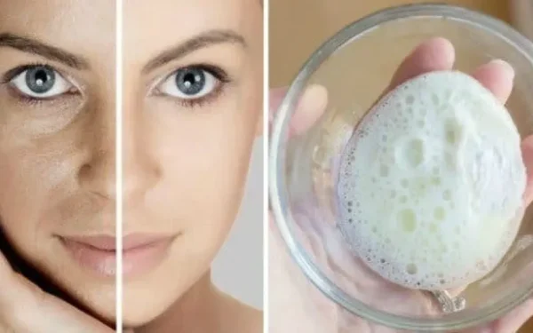 Recette : la célébre crème au bicarbonate de soude pour diminuer les rides, les taches et les boutons