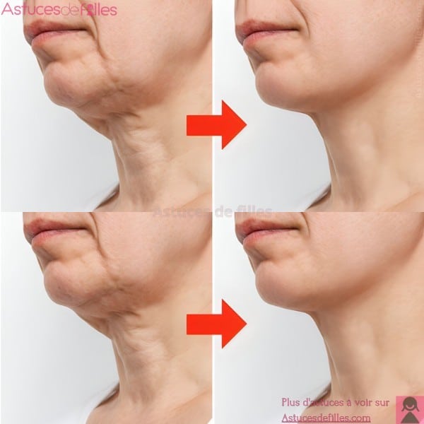 Soulevez Votre Cou Affaissé Naturellement: Astuces Efficaces en 10 Jours